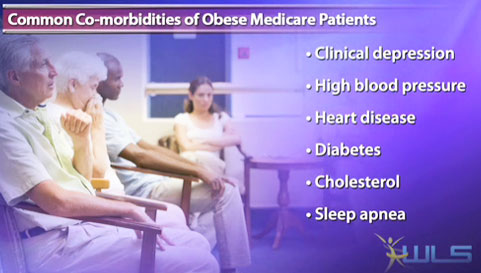 Medicare patients lose less weight after bariatric surgery