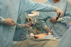 laparoscopic weight loss surgery