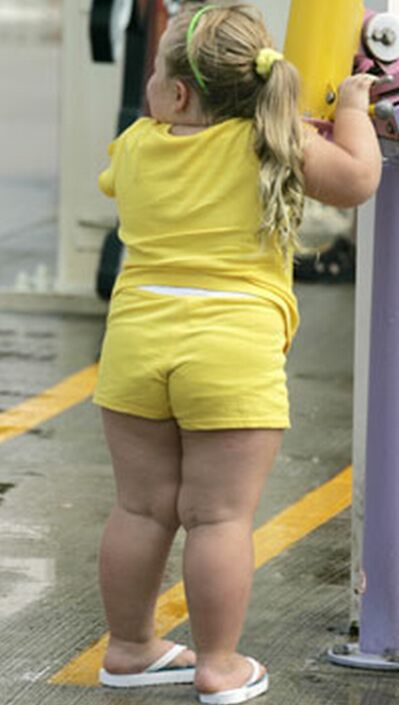 http://www.weightlosssurgerychannel.com/wp-content/uploads/2009/08/obese-child.jpg