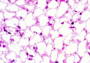 fatcell